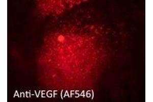 Immunostaining of primary RPE cells using VEGFAAb at 1/50 dilution, (VEGFA antibody  (Isoform 6))
