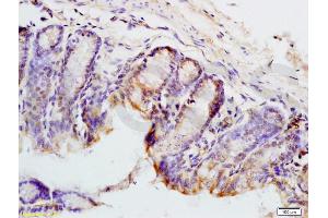 Formalin-fixed and mouse colon tissue labeled with Anti-PAX9 Polyclonal Antibody, Unconjugated (ABIN737691) at 1:200 followed by conjugation to the secondary antibody and DAB staining (PAX9 antibody  (AA 271-341))