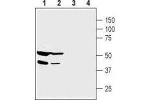 Western blot analysis of human  pancreatic carcinoma cell lysate (lanes 1 and 3) and human HepG2 liver carcinoma cell lysate (lanes 2 and 4):1,2.