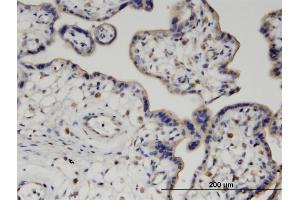 Immunoperoxidase of monoclonal antibody to PIGQ on formalin-fixed paraffin-embedded human placenta.