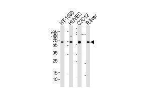 Western blot analysis of lysates from HT-1080, HUVEC, mouse C2C12 cell line and rat liver tissue lysate(from left to right), using SD1 Antibody (Center) (ABIN6242631 and ABIN6577423).