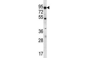 ABCD2 antibody western blot analysis in K562 lysate.