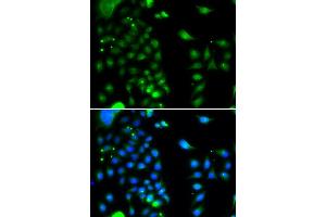 Immunofluorescence analysis of MCF-7 cells using UBE2J2 antibody.