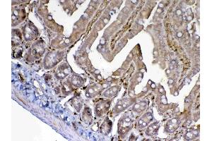 IHC analysis of ADA using anti-ADA antibody . (ADA antibody  (AA 2-238))