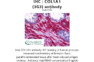 Image no. 2 for anti-Collagen, Type I, alpha 1 (COL1A1) (AA 1021-1108) antibody (ABIN1723789)