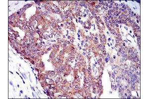 Immunohistochemistry (IHC) image for anti-Twinfilin, Actin-Binding Protein 1 (TWF1) (AA 335-384) antibody (ABIN1846307) (TWF1 antibody  (AA 335-384))