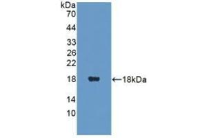 Detection of Recombinant PANK4, Human using Polyclonal Antibody to Pantothenate Kinase 4 (PANK4) (PANK4 antibody  (AA 639-773))