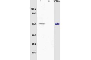 L1 human colon carcinoma lysate L2 mouse embryo lysates probed with Anti phospho-PPAR alpha(Ser12) Polyclonal Antibody, Unconjugated (ABIN753163) at 1:200 overnight at 4 °C. (PPARA antibody  (pSer12))
