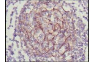 Immunohistochemical analysis of paraffin-embedded human lymph node using NTRK3 antibody with DAB staining. (NTRK3 antibody  (AA 32-429))