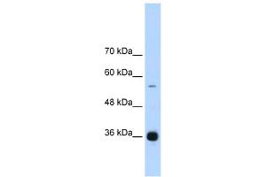 WB Suggested Anti-HNRPAB Antibody Titration:  1. (HNRNPAB antibody  (C-Term))
