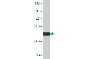 Western Blot detection against Immunogen (37. (HLA-DMB antibody  (AA 22-129))