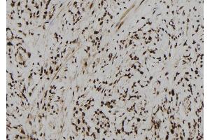 ABIN6261007 and ABIN6273104 at 1/100 staining Human gastric tissue by IHC-P.