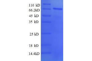 SDS-PAGE (SDS) image for Paired Box Gene 2a (PAX2A) (AA 1-363), (partial) protein (GST tag) (ABIN5712780)