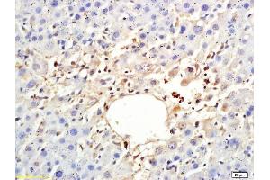 Formalin-fixed and paraffin embedded rat liver labeled with Anti-ARP4 Polyclonal Antibody, Unconjugated (ABIN708581) at 1:200 followed by conjugation to the secondary antibody (BAF53A antibody  (AA 331-410))