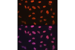 Immunofluorescence analysis of U-2 OS cells using B/SM Rabbit mAb (ABIN1679391, ABIN3018128, ABIN3018129 and ABIN7101578) at dilution of 1:100 (40x lens).