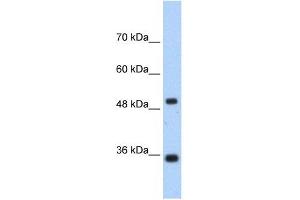 FBP1 antibody used at 1. (FBP1 antibody  (N-Term))