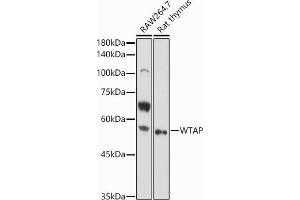 Western blot analysis of extracts of various cell lines, using WTAP antibody (ABIN7271372) at 1:1000 dilution. (WTAP antibody  (AA 1-396))