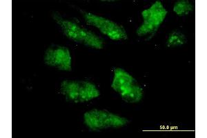 Immunofluorescence of monoclonal antibody to EIF2AK2 on HeLa cell. (EIF2AK2 antibody  (AA 1-100))