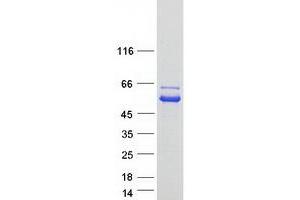 Validation with Western Blot (NAGS Protein (Myc-DYKDDDDK Tag))