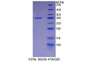 SDS-PAGE (SDS) image for L1 Cell Adhesion Molecule (L1CAM) ELISA Kit (ABIN6720565)