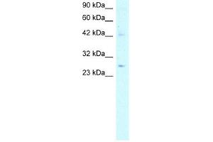 ACDC antibody used at 5 ug/ml to detect target protein. (ADIPOQ antibody  (N-Term))