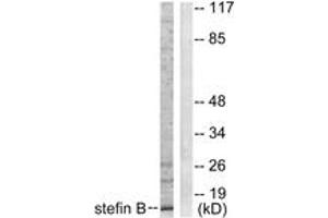 Western blot analysis of extracts from A549 cells, using Stefin B Antibody. (CSTB antibody  (AA 49-98))