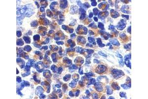 Immunohistochemistry of DAPK2 in mouse spleen cells with DAPK2 polyclonal antibody  at 2 ug/mL .