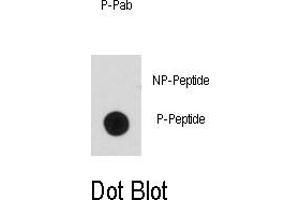 Image no. 2 for anti-BCL2-Associated Agonist of Cell Death (BAD) (pSer99) antibody (ABIN358087) (BAD antibody  (pSer99))