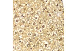 Immunohistochemistry of paraffin-embedded mouse liver using PYCARD antibody at dilution of 1:100 (400x lens).