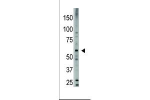 The anti-Bmp6 (N-term) Pab (ABIN388456 and ABIN2848818) is used in Western blot to detect Bmp6 in HL60 cell lysate. (BMP6 antibody  (N-Term))