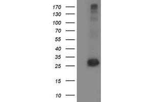 Western Blotting (WB) image for anti-Sirtuin 5 (SIRT5) antibody (ABIN1500931) (SIRT5 antibody)