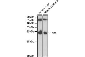 Western blot analysis of extracts of various cell lines, using LY86 antibody (ABIN6128208, ABIN6143395, ABIN6143396 and ABIN6221778) at 1:1000 dilution.
