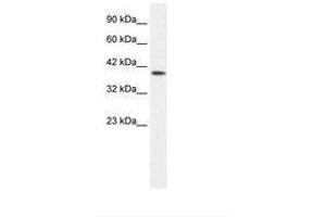 Image no. 2 for anti-Purinergic Receptor P2X, Ligand Gated Ion Channel 2 (P2RX2) (AA 106-155) antibody (ABIN203093) (P2RX2 antibody  (AA 106-155))