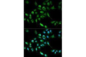 Immunofluorescence analysis of HepG2 cell using ADH5 antibody.