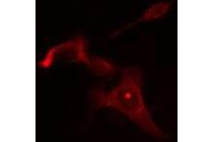 ABIN6275058 staining Hela cells by IF/ICC. (DGAT2L6 antibody  (C-Term))