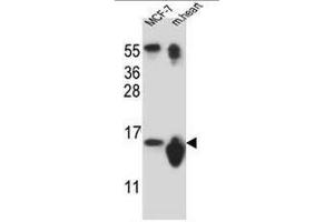 SNRPD3 Antibody (N-term) western blot analysis in MCF-7 cell line ans mouse heart tissue lysates (35µg/lane).