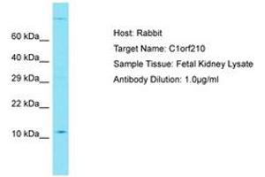 Image no. 1 for anti-Chromosome 1 Open Reading Frame 210 (C1ORF210) (AA 42-91) antibody (ABIN6750765) (C1ORF210 antibody  (AA 42-91))