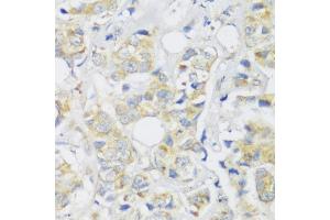 Immunohistochemistry (IHC) image for anti-SNAIL (SNAI1) (C-Term) antibody (ABIN6148177)