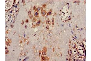 Immunohistochemistry of paraffin-embedded human placenta tissue using ABIN7163916 at dilution of 1:100