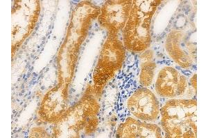 ABIN6263116 and ABIN6266862 at 1/100 staining human normal kidney tissue by IHC-P. (ERK1 antibody  (C-Term))