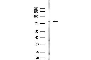 anti-Zinc Finger, SWIM-Type Containing 3 (ZSWIM3) antibody
