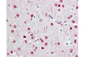 Anti-WDR5 antibody IHC staining of human brain, cortex.