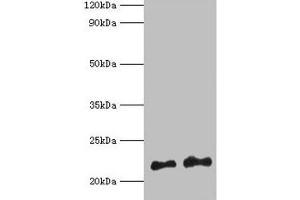 Western blot All lanes: Hras antibody at 2 μg/mL Lane 1: 293T whole cell lysate Lane 2: Mouse brain tissue Secondary Goat polyclonal to rabbit IgG at 1/10000 dilution Predicted band size: 22 kDa Observed band size: 22 kDa (HRAS antibody  (AA 2-186))