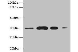 Western blot All lanes: SULT1A3 antibody at 20 μg/mL Lane 1: A549 whole cell lysate Lane 2: Colo320 whole cell lysate Lane 3: Mouse brain tissue Lane 4: Mouse kidney tissue Secondary Goat polyclonal to rabbit IgG at 1/10000 dilution Predicted band size: 35, 23 kDa Observed band size: 35 kDa (SULT1A3 antibody  (AA 1-295))