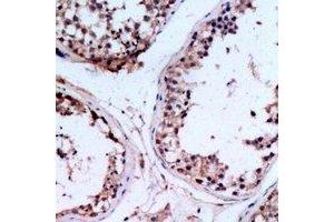 Immunohistochemical analysis of CHST9 staining in human testis formalin fixed paraffin embedded tissue section. (CHST9 antibody  (C-Term))
