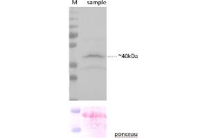 Sample preparation and immunoblot analysis were carried out as described in Karnik et al. (YFP antibody  (C-Term))