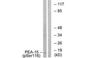 Western blot analysis of extracts from COS7 cells treated with INSULIN 0. (PEA15 antibody  (pSer116))