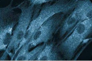 Immunofluorescent staining of HISM cells with anti-NCK antibody. (NCK1 antibody  (AA 279-377))