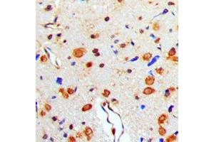 Immunohistochemical analysis of TAU (pT529) staining in human brain formalin fixed paraffin embedded tissue section. (tau antibody  (pSer529))