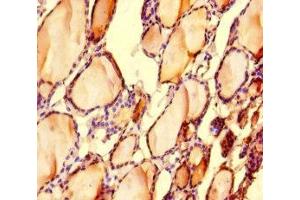 Immunohistochemistry of paraffin-embedded human thyroid tissue using ABIN7158488 at dilution of 1:100 (LONP1 antibody  (AA 614-959))